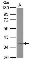 Anti-Adiponectin Receptor 1 antibody [C2C3], C-term used in Western Blot (WB). GTX104770